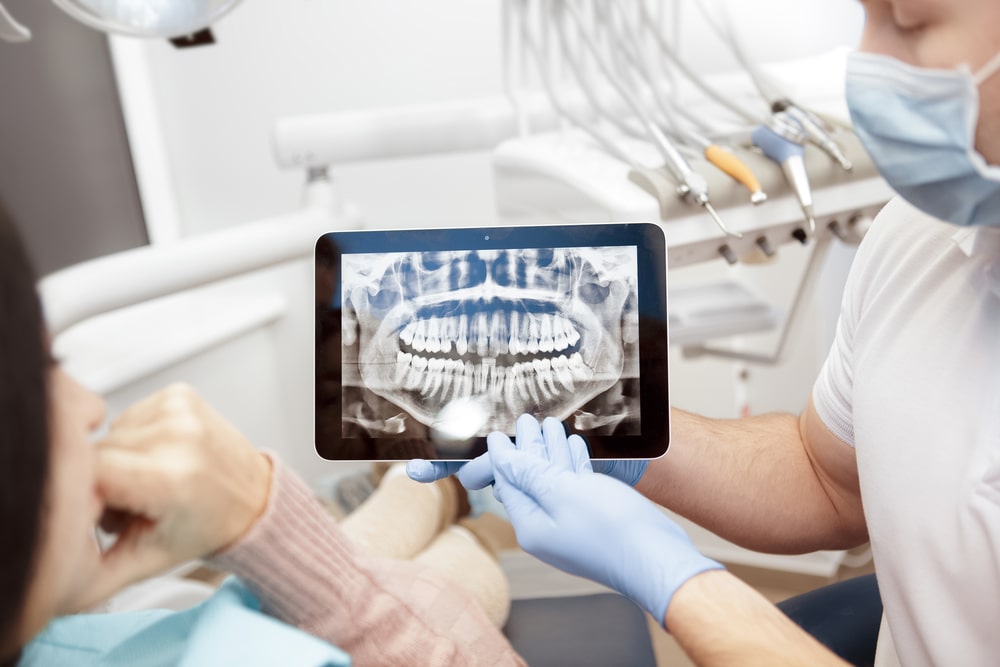 Radiographies dentaires : un outil de diagnostic et de planification