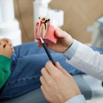 Un dentiste montre un modèle de dent infectée nécessitant un traitement de canal