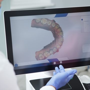 Le scan iTero prend des empreintes numériques de la dentition