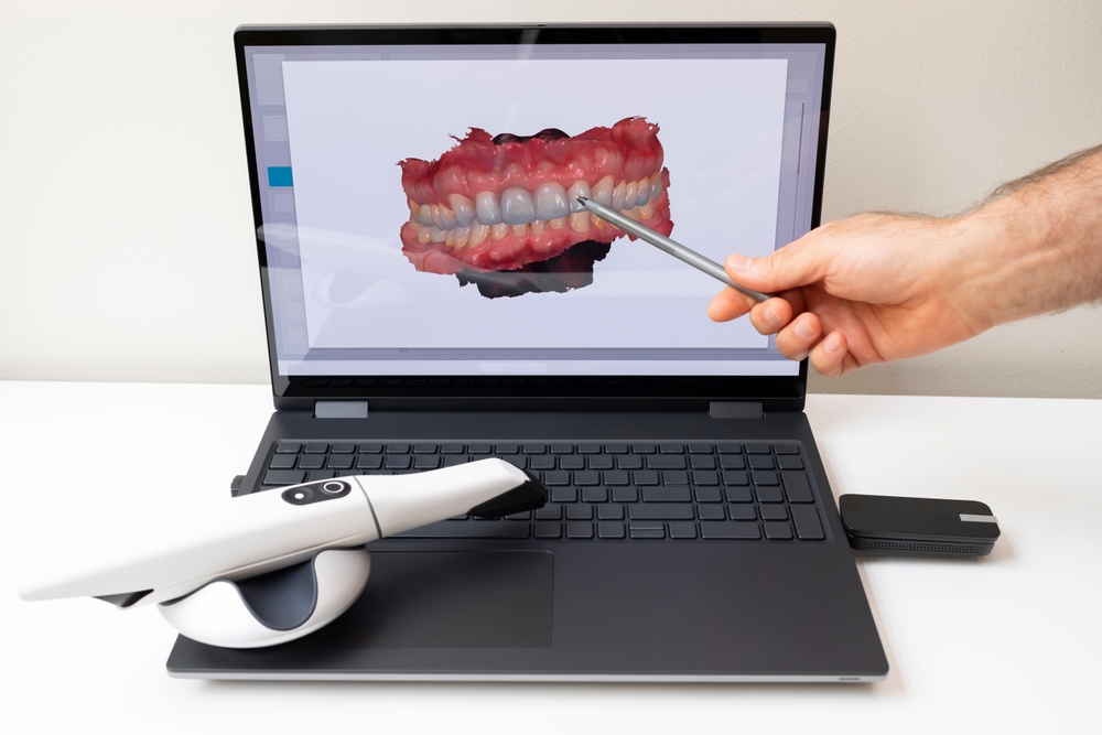 Les empreintes optiques utilisées pour la simulation Invisalign